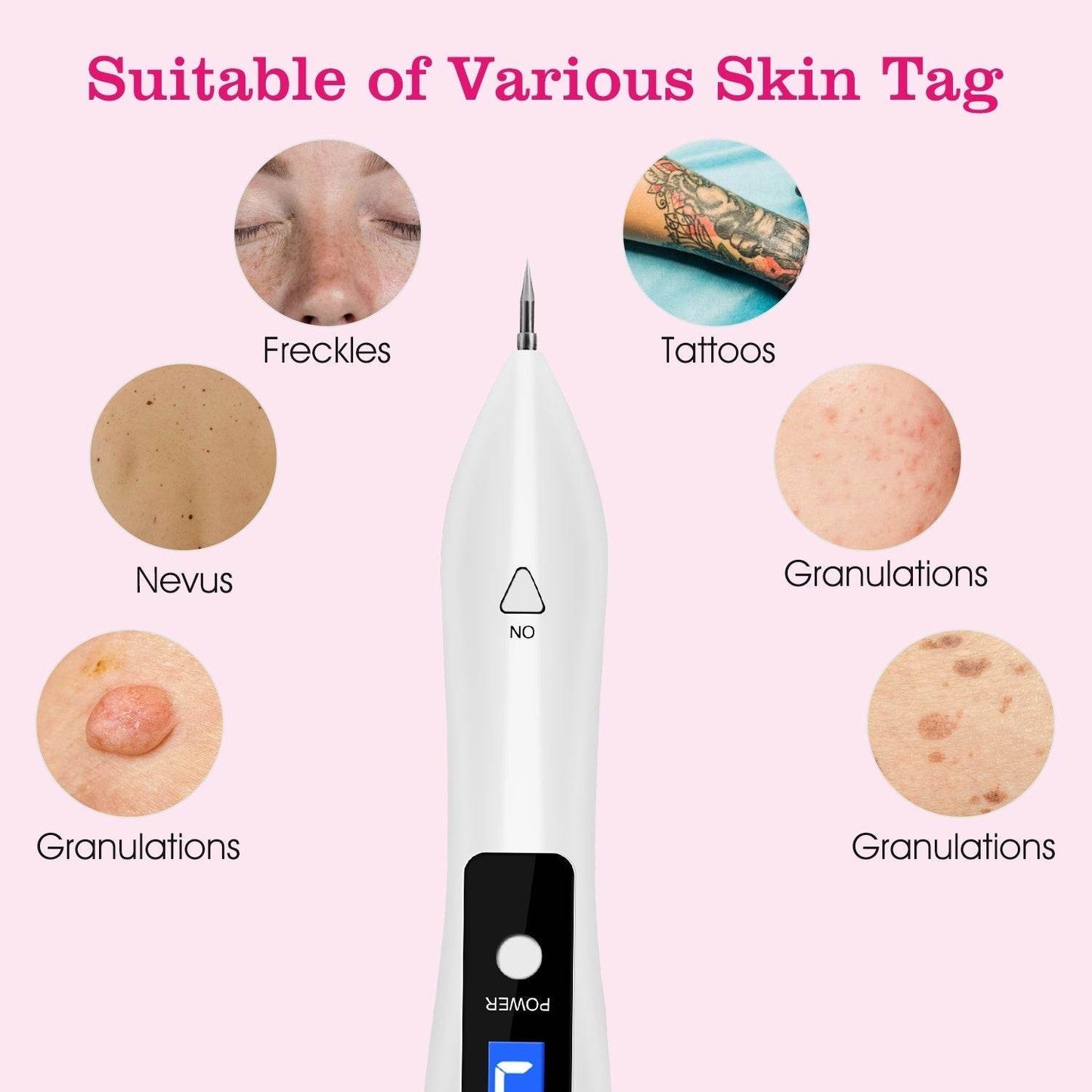 1Pc Skin Tag Repair Kit Portable Beauty Equipment Multi-Level With Home Usage USB Charging LCD Level Adjustable 6 Replaceable Needles - Velora
