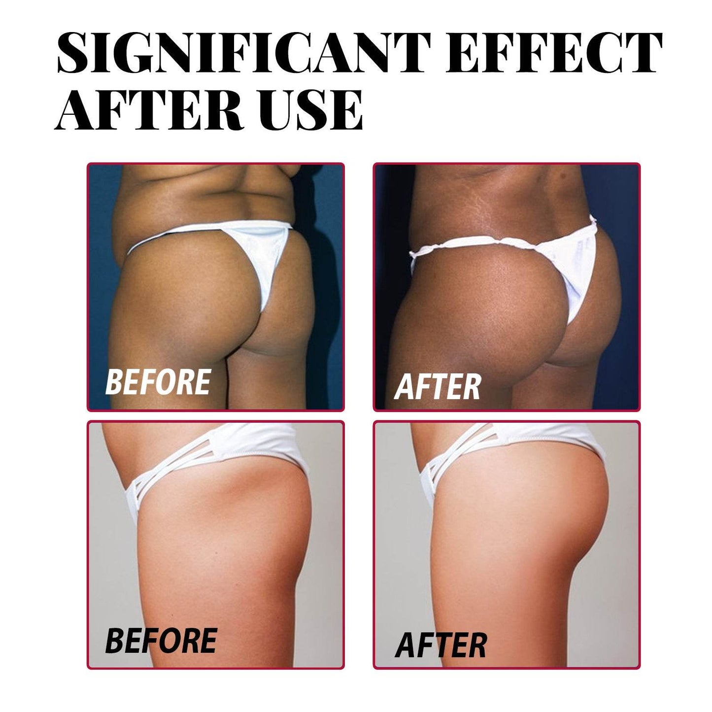 Plump Buttock Cream Lifts And Tightens Buttocks - Velora