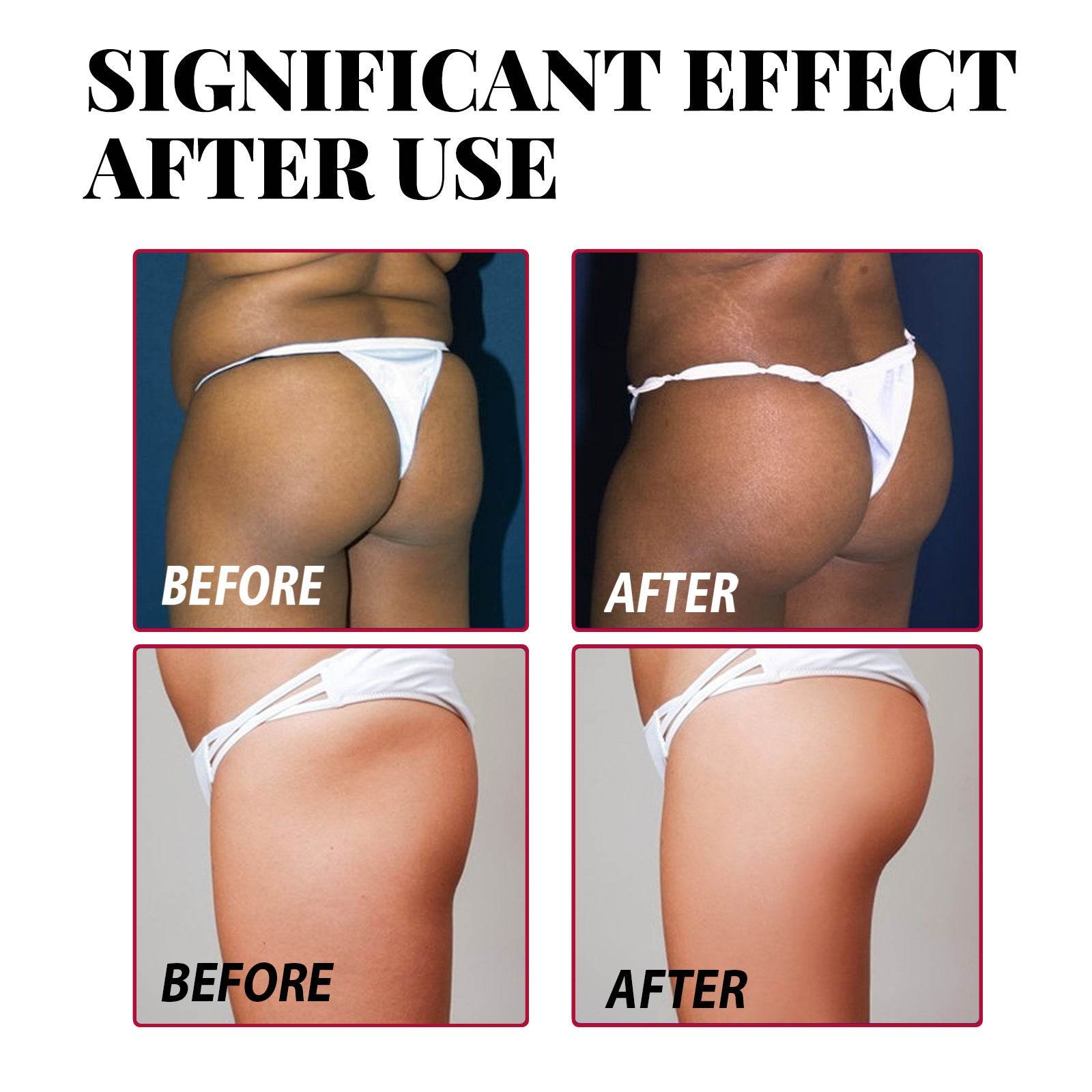 Plump Buttock Cream Lifts And Tightens Buttocks - Velora