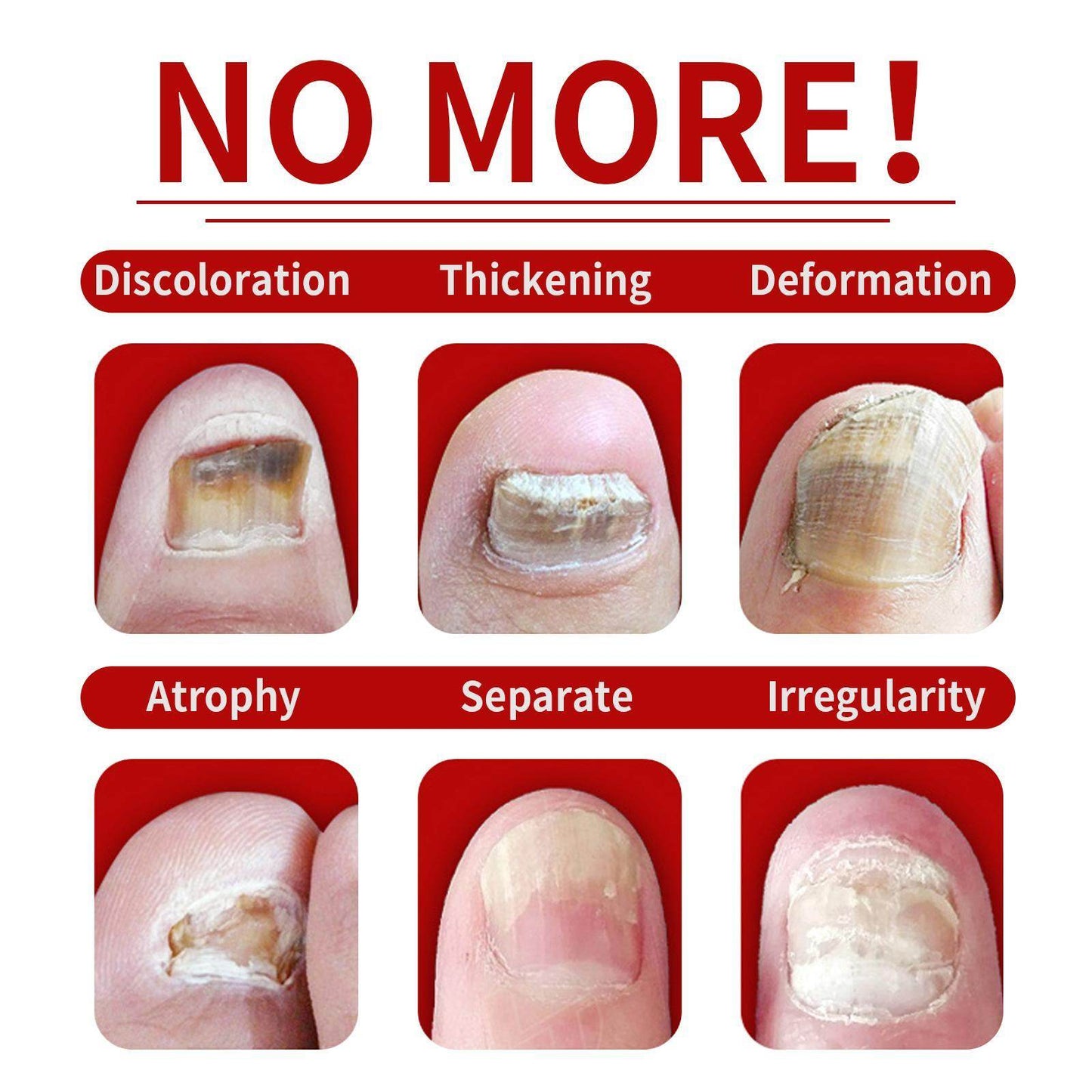 Jiasuying Ginger Nail Care Liquid, Repairs And Moisturizes Hand And Foot Nails, Makes Nails Shiny And Soft, And Improves Onychomycosis - Velora