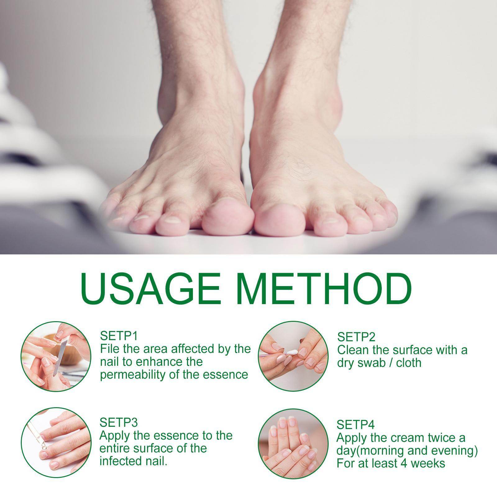 Jiasuying Ginger Nail Care Liquid, Repairs And Moisturizes Hand And Foot Nails, Makes Nails Shiny And Soft, And Improves Onychomycosis - Velora