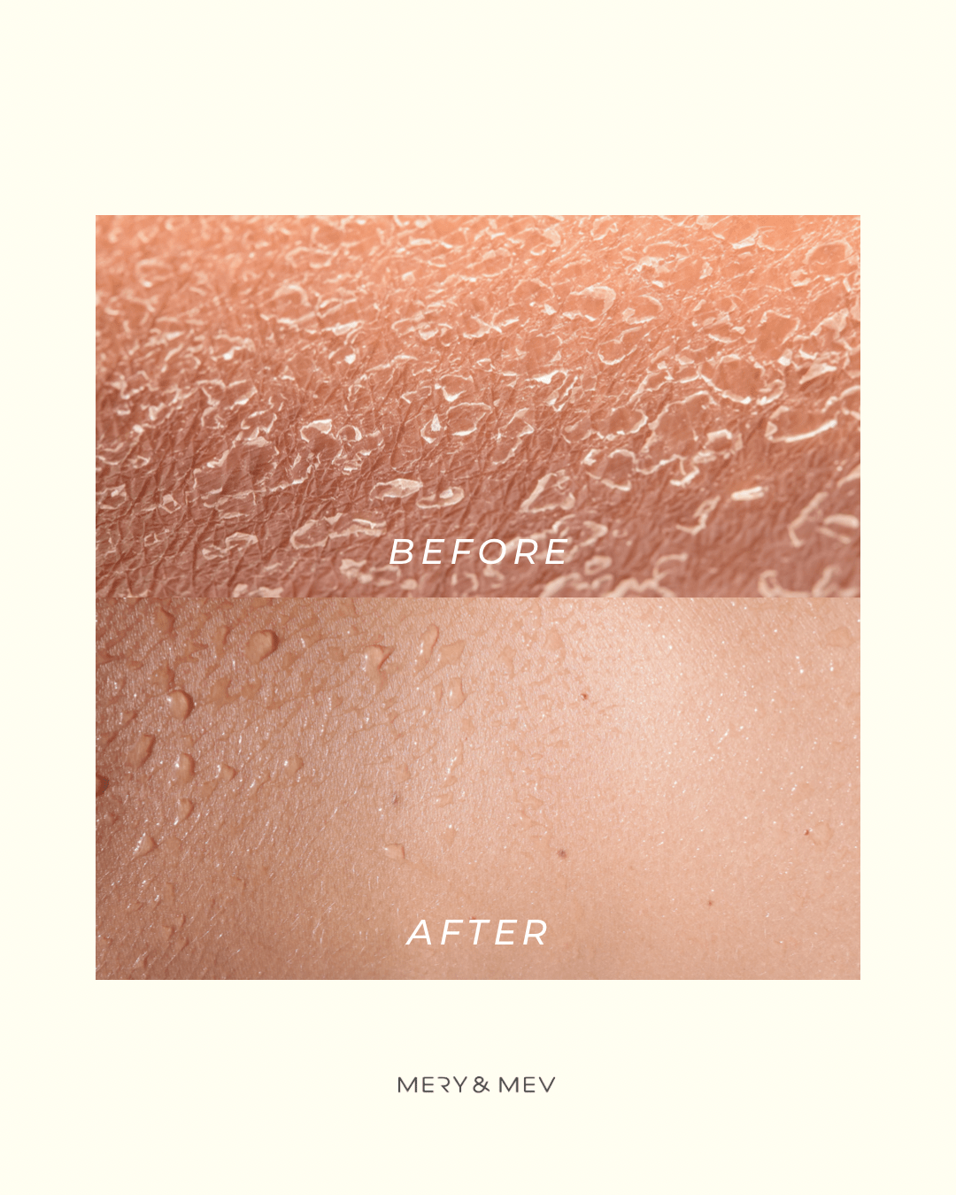 Body Exfoliating Gloves 2PC - Velora Luxury Fashion