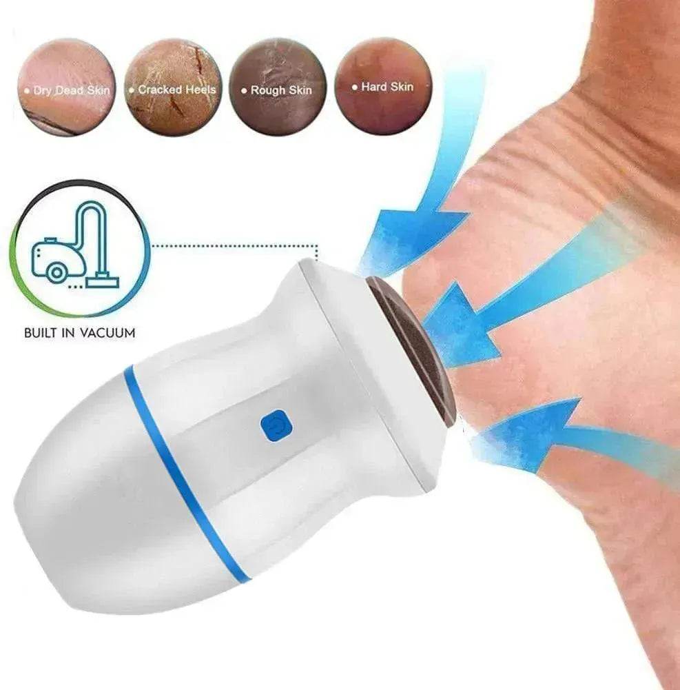 Exfoliate Dead Skin Callus Remover Heel Electric Vacuum Foot Grinder File Machine - Velora