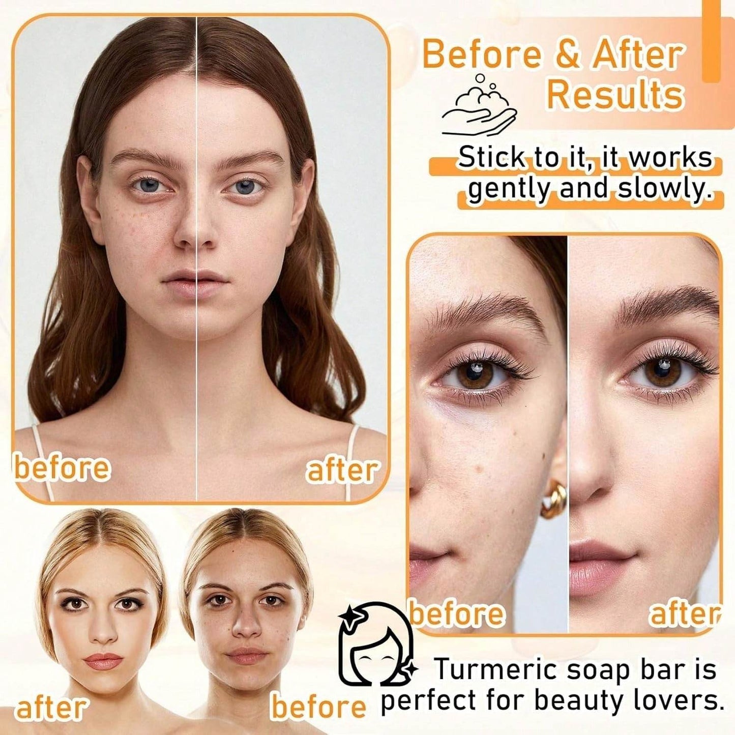 Body Face Brightening Turmeric Hyperpigmentation Bar Soap - Velora