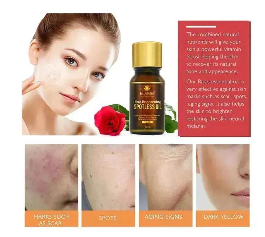 ELAIMEI Ultra Whitening Brightening Spotless Oil Freckles and Dark Spot Remover - Velora