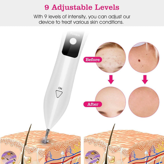 1Pc Skin Tag Repair Kit Portable Beauty Equipment Multi-Level With Home Usage USB Charging LCD Level Adjustable 6 Replaceable Needles - Velora