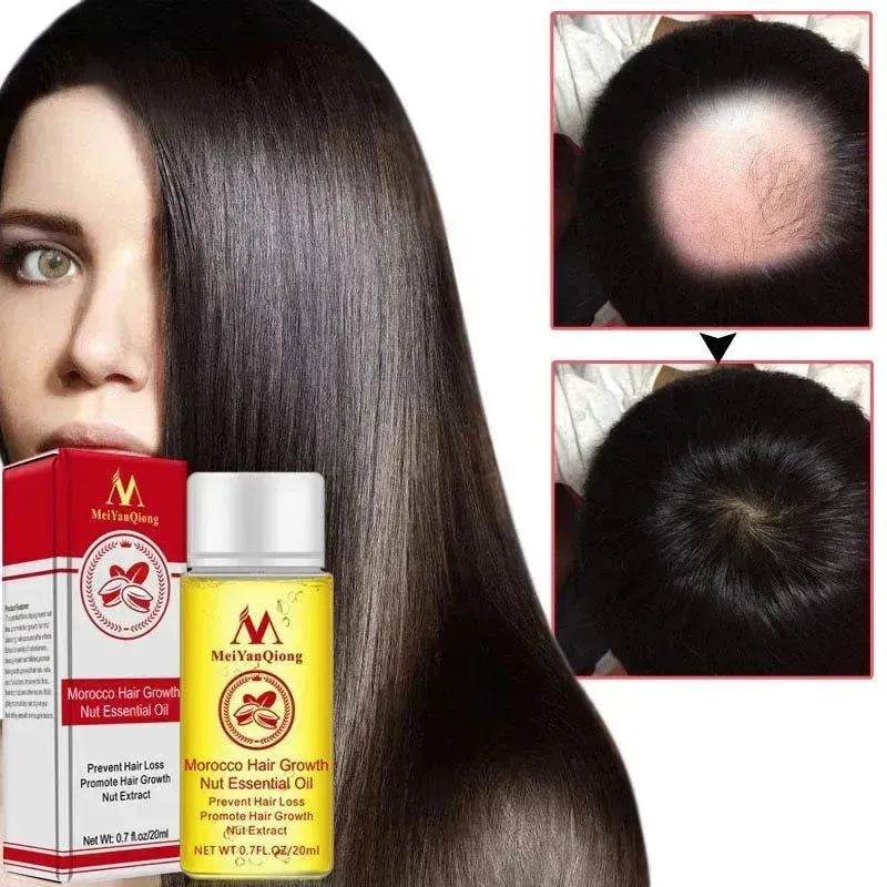 Hair Care Essential Oil , Promote Hair Growth, Shinny smooth texture, Moisturizes hair - Velora