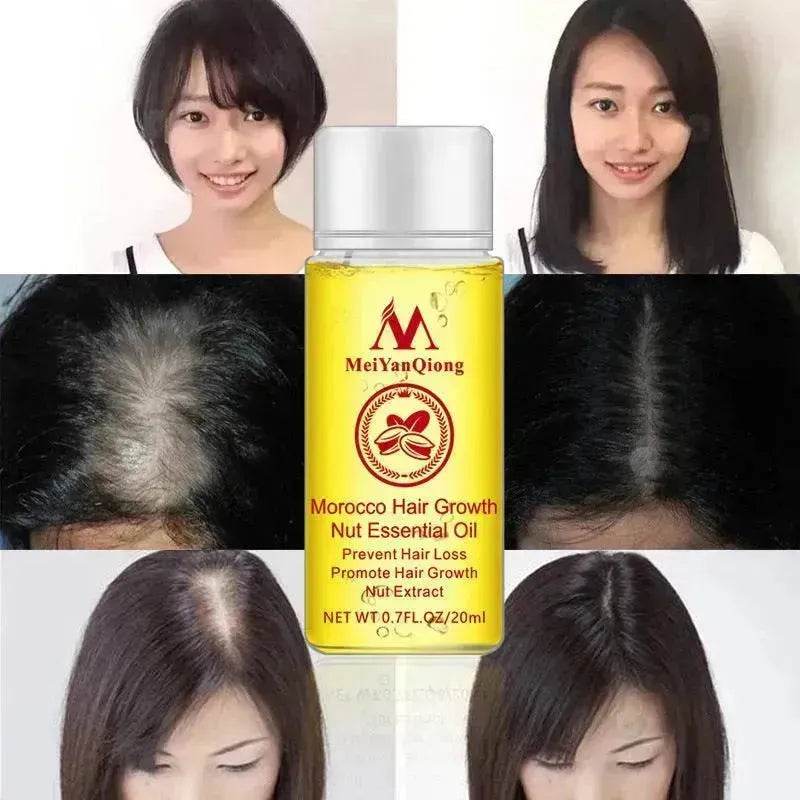 Hair Care Essential Oil , Promote Hair Growth, Shinny smooth texture, Moisturizes hair - Velora