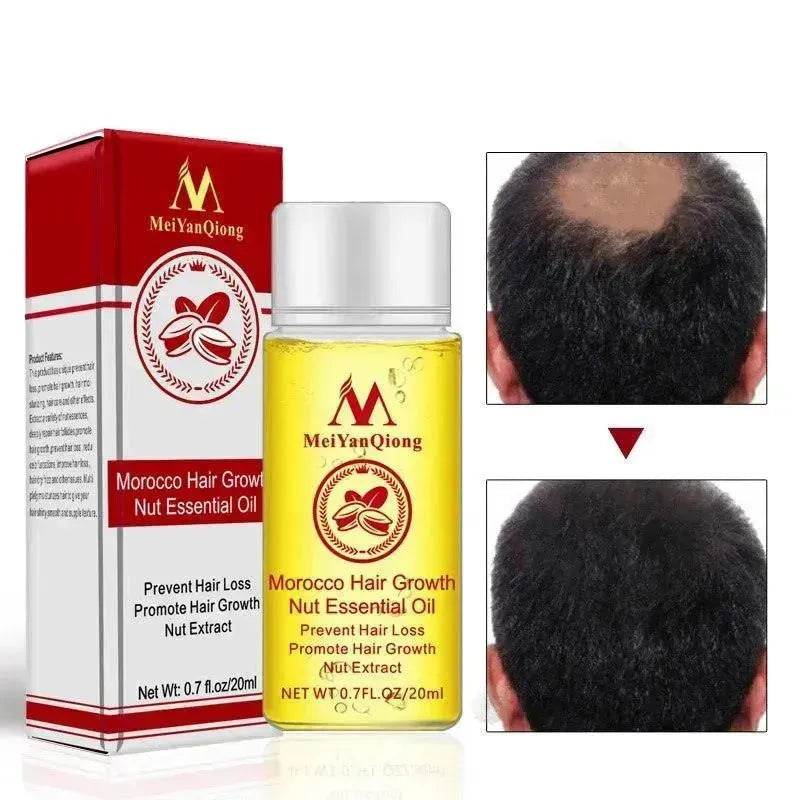 Hair Care Essential Oil , Promote Hair Growth, Shinny smooth texture, Moisturizes hair - Velora