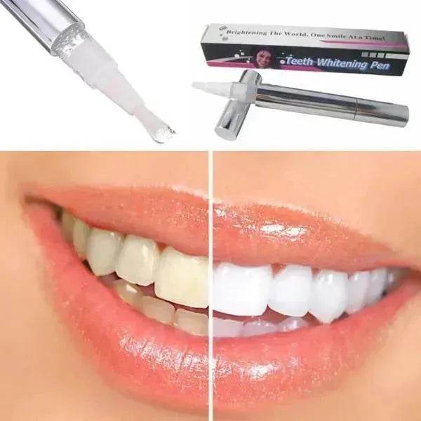 Teeth Whitening Pen - Velora